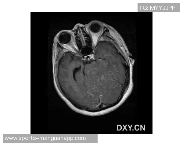 文班MRI检查结果揭晓好消息他未遭受结构性损伤恢复在望
